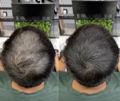 Chic™  hair filler powder