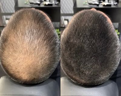 Chic™  hair filler powder