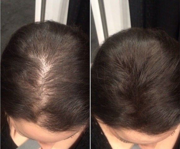 Chic™  hair filler powder