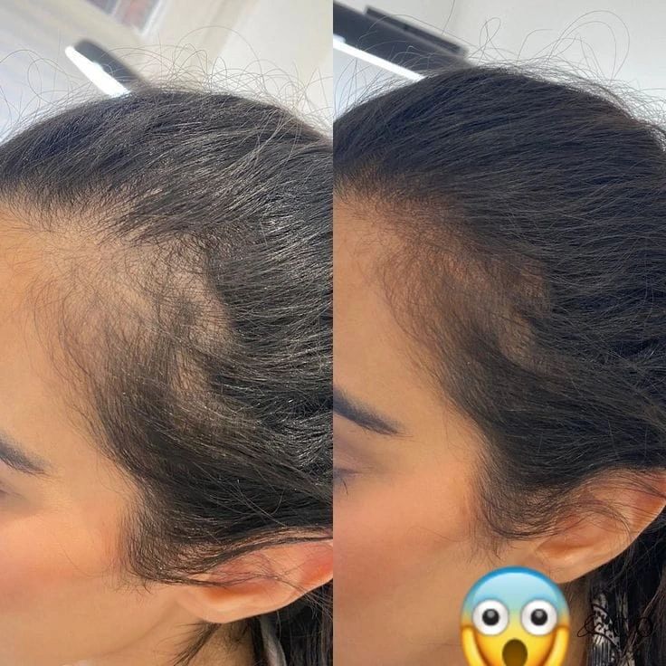 Chic™  hair filler powder