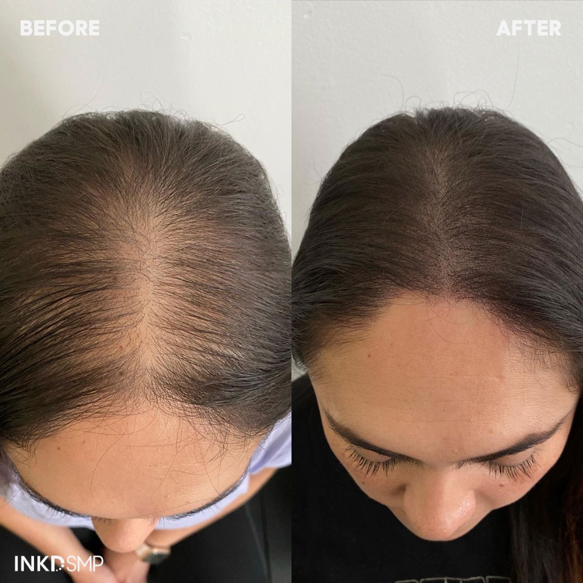 Chic™  hair filler powder